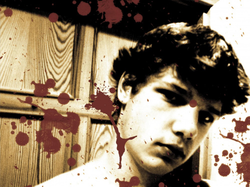 Bloody Matt. #blood
