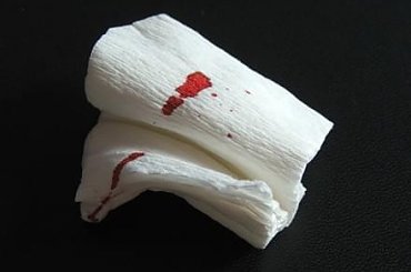 #plik #tampon #krew #zyzio